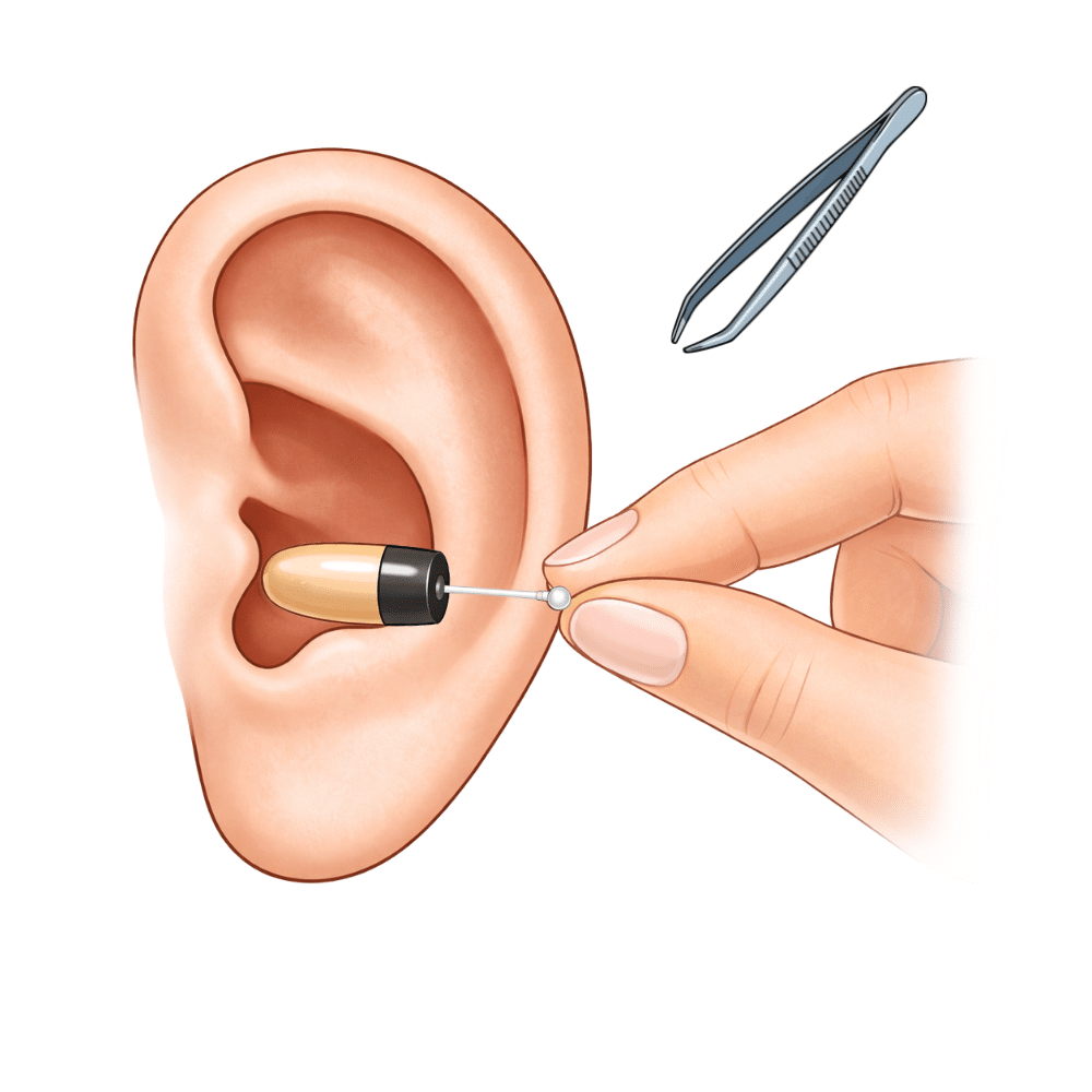 Pinganillo Vip Pro Extracción